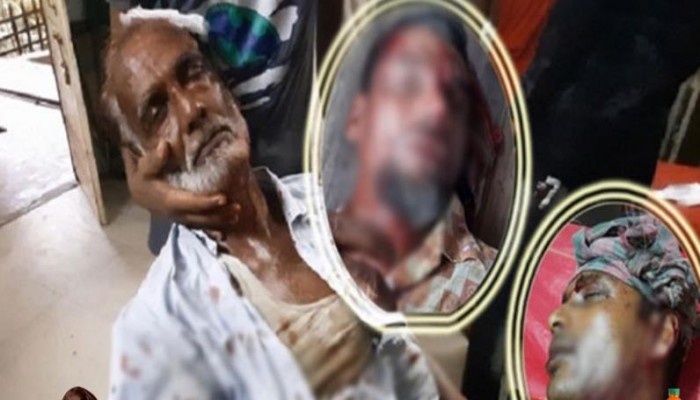 মোংলায় আ’লীগের দুই গ্রুপের রক্তক্ষয়ী সংঘর্ষ, আহত ১৪