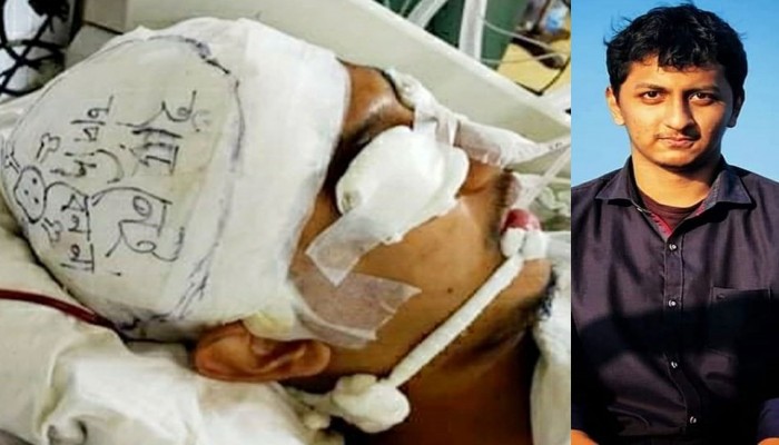 হাড় নেই, চাপ দেবেন না’ সেই আকিবের জ্ঞান ফিরেছে