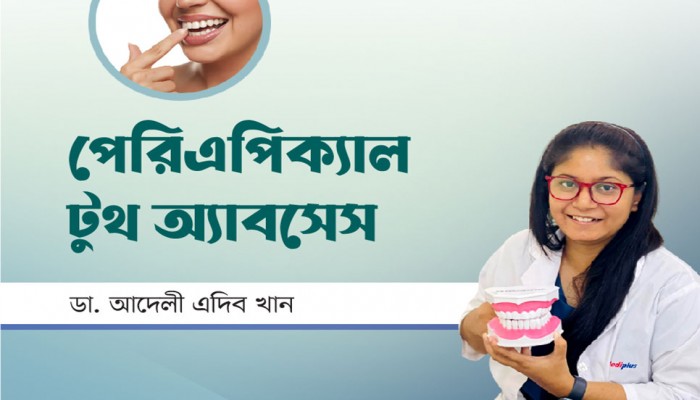 পেরিএপিক্যাল টুথ অ্যাবসেস