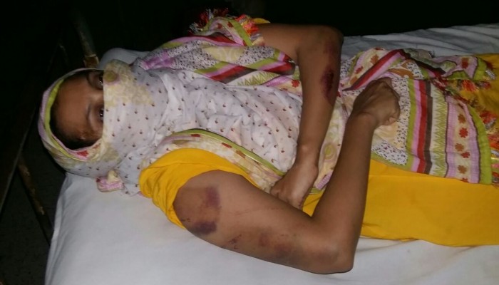 ভালুকায় জমি নিয়ে বিরোধে চাচার হাতে দুই ভাতীজি আহত,থানায় মামলা।