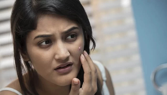 ব্রণ হলে কী করবেন, কী করবেন না