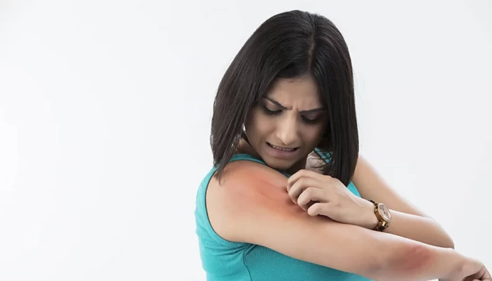 মশা কি লোক বুঝে কামড়ায়